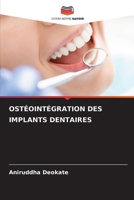 Ostéointégration Des Implants Dentaires (French Edition) 6209814832 Book Cover