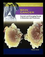 Skin Cancer: Current And Emerging Trends in Detection And Treatment (Cancer and Modern Science) 1404203907 Book Cover