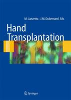 Hand transplantation 8847057965 Book Cover
