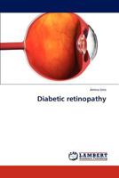 Diabetic retinopathy 3846593419 Book Cover