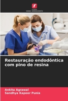 Restauração endodôntica com pino de resina (Portuguese Edition) 6207437616 Book Cover