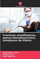 Fracturas mandibulares, placas bioreabsorvíveis, miniplacas de titânio (Portuguese Edition) 6207891260 Book Cover