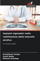 Impianti zigomatici nella riabilitazione della mascella atrofica (Italian Edition) 6209894992 Book Cover
