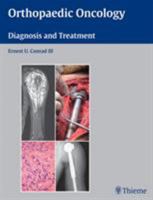 Orthopaedic Oncology: Diagnosis and Treatment 1588905233 Book Cover