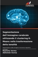 Segmentazione dell'immagine cerebrale utilizzando il clustering K-Means nella trasformazione della tonalità: Segmentazione delle immagini di risonanza magnetica cerebrale (Italian Edition) B0CK3HKTXY Book Cover