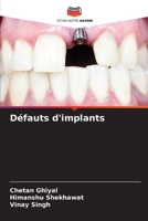Défauts d'implants (French Edition) 6208387183 Book Cover