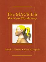 The Macs-lift Short Scar Rhytidectomy 1576261913 Book Cover