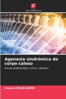 Agenesia sindrómica do corpo caloso (Portuguese Edition) 6208145392 Book Cover