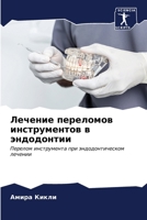 Лечение переломов инстр& 6206859576 Book Cover