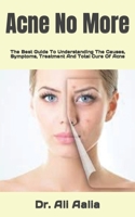 Acne No More: The Best Guide To Understanding The Causes, Symptoms, Treatment And Total Cure Of Acne null Book Cover