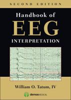 Handbook of EEG Interpretation 1620700166 Book Cover