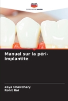 Manuel sur la péri-implantite (French Edition) 6209330843 Book Cover