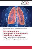 Atlas de Cuerpos Ferruginosos Retenidos En Pulmones Humanos 3848456125 Book Cover