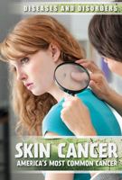 Skin Cancer: America's Most Common Cancer 1534564888 Book Cover