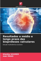 Resultados a médio e longo prazo das biopróteses valvulares (Portuguese Edition) 6208198046 Book Cover