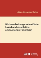 Bildverarbeitungsunterstützte Laserknochenablation am humanen Felsenbein 3866444583 Book Cover