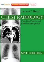 Chest Radiology -- Plain Film Patterns and Differential Diagnoses