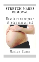 Stretch Marks Removal: How to remove your stretch marks fast 1097469212 Book Cover