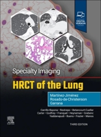 Specialty Imaging: Hrct of the Lung 0443286361 Book Cover