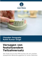 Versagen von festsitzendem Teilzahnersatz (German Edition) 6207552032 Book Cover