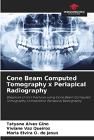 Cone Beam Computed Tomography x Periapical Radiography: Diagnosis of root fractures using Cone Beam Computed Tomography compared to Periapical Radiography B0CH23SR1Z Book Cover