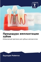 Процедура имплантации з& 6206993612 Book Cover