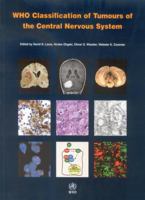 Who Classification of Tumours of the Central Nervous System (Who Classfication of Tumours) 9283224302 Book Cover