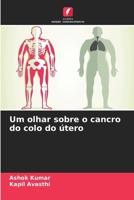 Um olhar sobre o cancro do colo do útero (Portuguese Edition) 6207863186 Book Cover