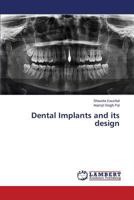 Dental Implants and its design 3659592293 Book Cover