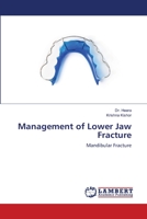 Management of Lower Jaw Fracture: Mandibular Fracture 6200270236 Book Cover