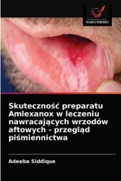 Skutecznośc preparatu Amlexanox w leczeniu nawracających wrzod�w aftowych - przegląd piśmiennictwa 6203347892 Book Cover