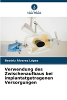Verwendung des Zwischenaufbaus bei implantatgetragenen Versorgungen (German Edition) 6206954277 Book Cover