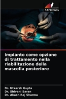 Impianto come opzione di trattamento nella riabilitazione della mascella posteriore 6204032380 Book Cover