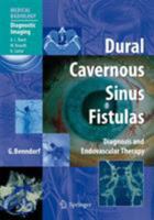 Dural Cavernous Sinus Fistulas: Diagnosis and Endovascular Therapy 3642235972 Book Cover