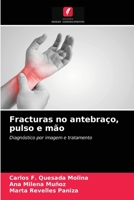 Fracturas no antebraço, pulso e mão 6203332712 Book Cover