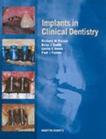 Implants in Clinical Dentistry 1853178055 Book Cover