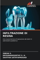 INFILTRAZIONE DI RESINA: Una nuova tecnica di riparazione dei denti in odontoiatria pediatrica (Italian Edition) B0CHL7DHB6 Book Cover