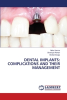 Dental Implants: Complications and Their Management 6206142116 Book Cover