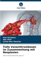 Tiefe Venenthrombosen im Zusammenhang mit Neoplasien (German Edition) 6209548288 Book Cover