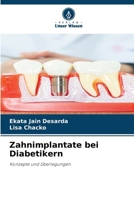 Zahnimplantate bei Diabetikern 6202363770 Book Cover