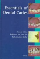 Essentials of Dental Caries 0192626922 Book Cover