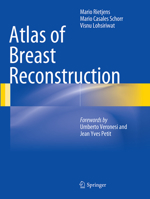 Atlas of Breast Reconstruction 8847055180 Book Cover
