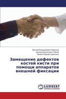 Zameshchenie defektov kostey kisti pri pomoshchi apparatov vneshney fiksatsii 3659549347 Book Cover