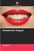 Ortodontia lingual (Portuguese Edition) 6202213671 Book Cover