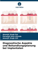 Diagnostische Aspekte und Behandlungsplanung bei Implantaten (German Edition) 620984152X Book Cover