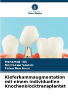 Kieferkammaugmentation mit einem individuellen Knochenblocktransplantat (German Edition) 6207162528 Book Cover