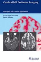 Cerebral Mr Perfusion Imaging: Principles and Current Applications 3131054018 Book Cover