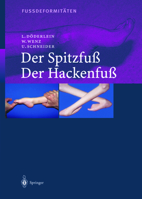 Fussdeformitaten: Der Spitzfuss/Der Hackenfuss 3642622062 Book Cover