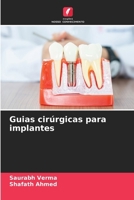 Guias cirúrgicas para implantes (Portuguese Edition) 6207663616 Book Cover