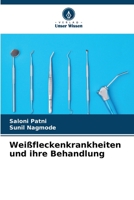 Weißfleckenkrankheiten und ihre Behandlung (German Edition) 6206495183 Book Cover